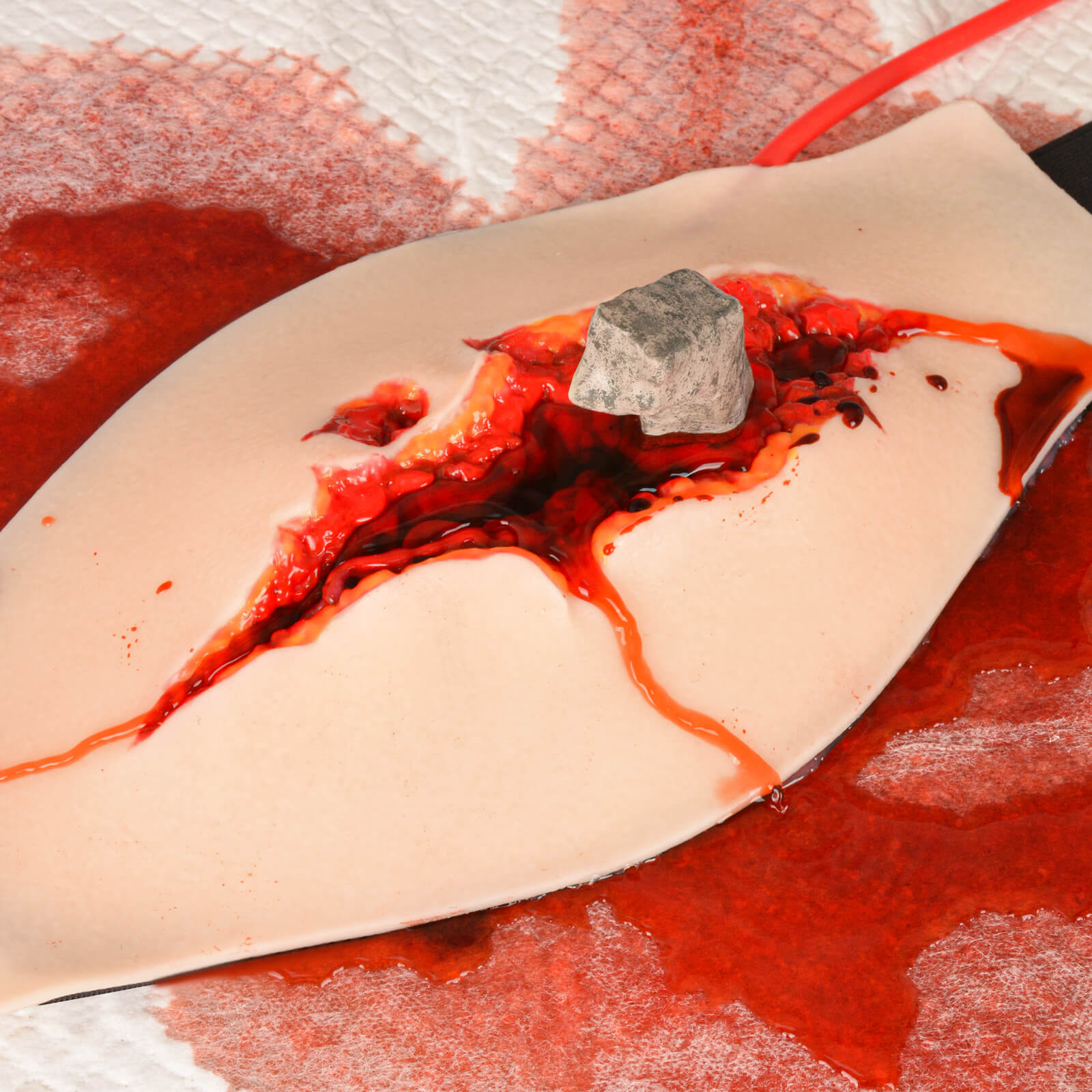 Wearable Penetrating Abdominal Trauma Trainer Kit