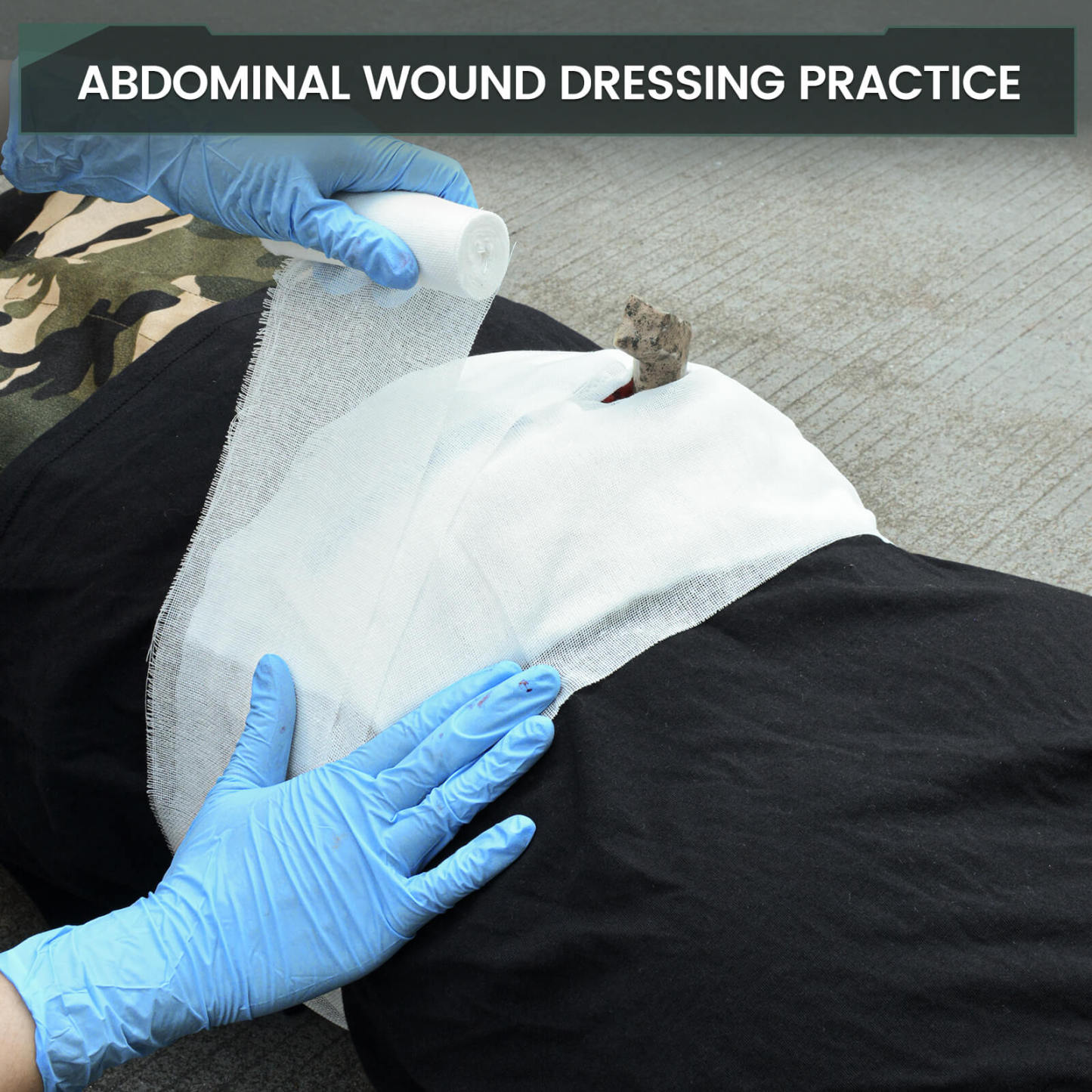 Wearable Penetrating Abdominal Trauma Trainer Kit