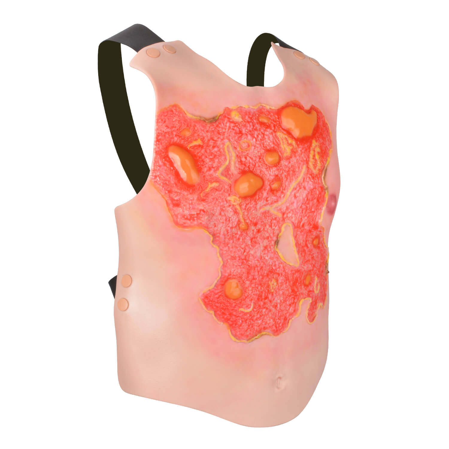 Wearable Adult Chest Burn Injury Simulation Model