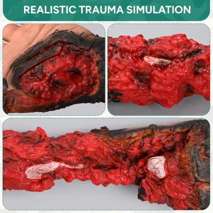 Wearable Arm Amputation Trauma Wound Packing Training Kit