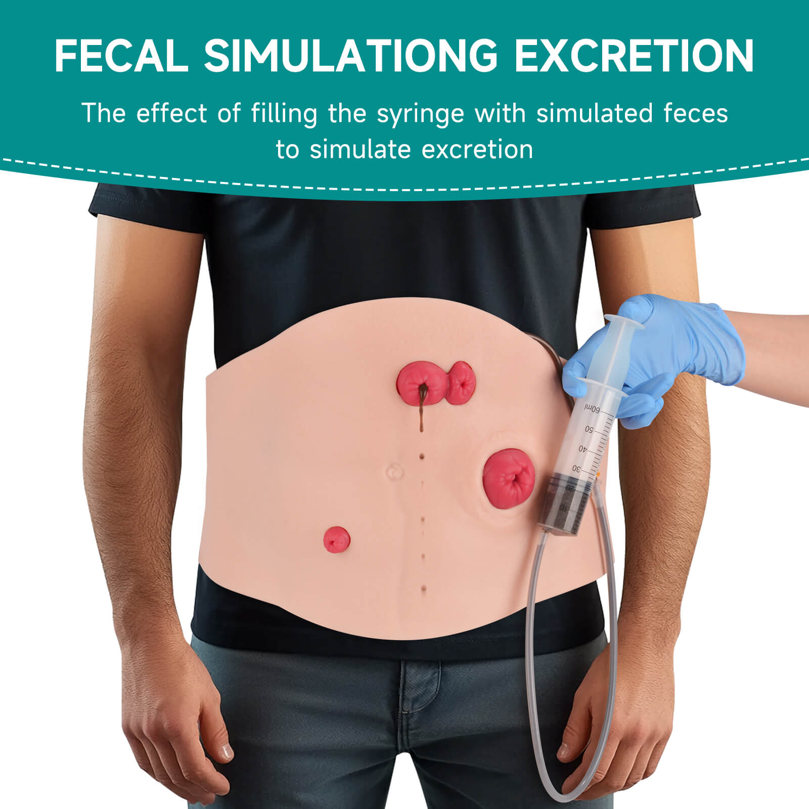 Wearable Belly Ostomy Care Trainer Kit with Simulated Excretion
