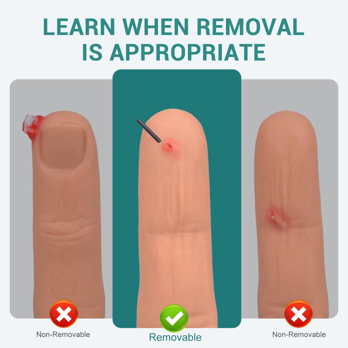 Wearable Finger Foreign Object Wound Simulation Trainer