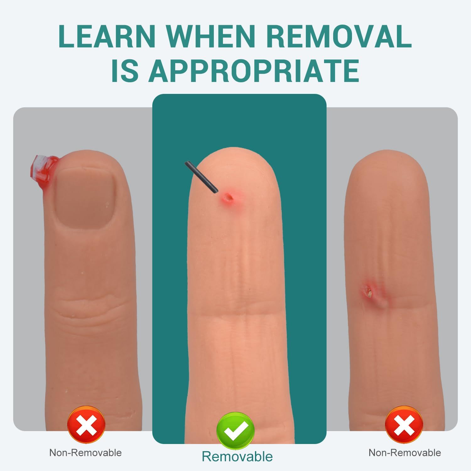 Wearable Finger Foreign Object Wound Simulation Trainer