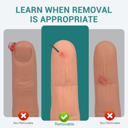 Wearable Finger Foreign Object Wound Simulation Trainer