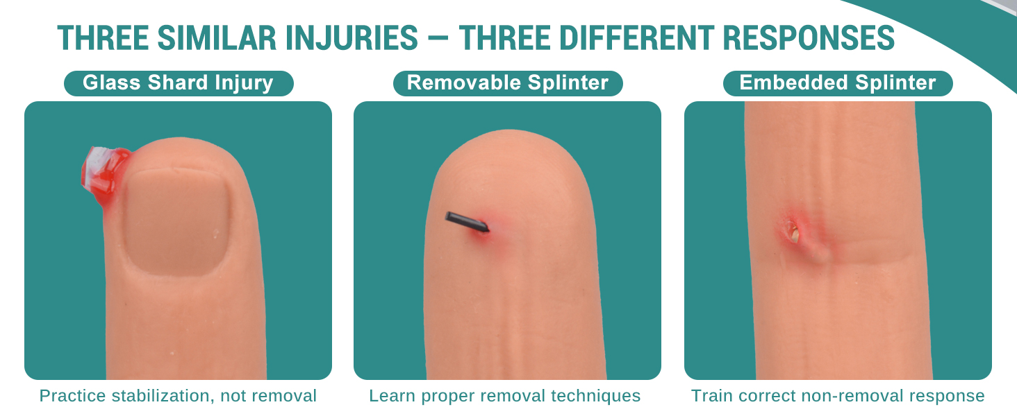Wearable Finger Foreign Object Wound Simulation Trainer