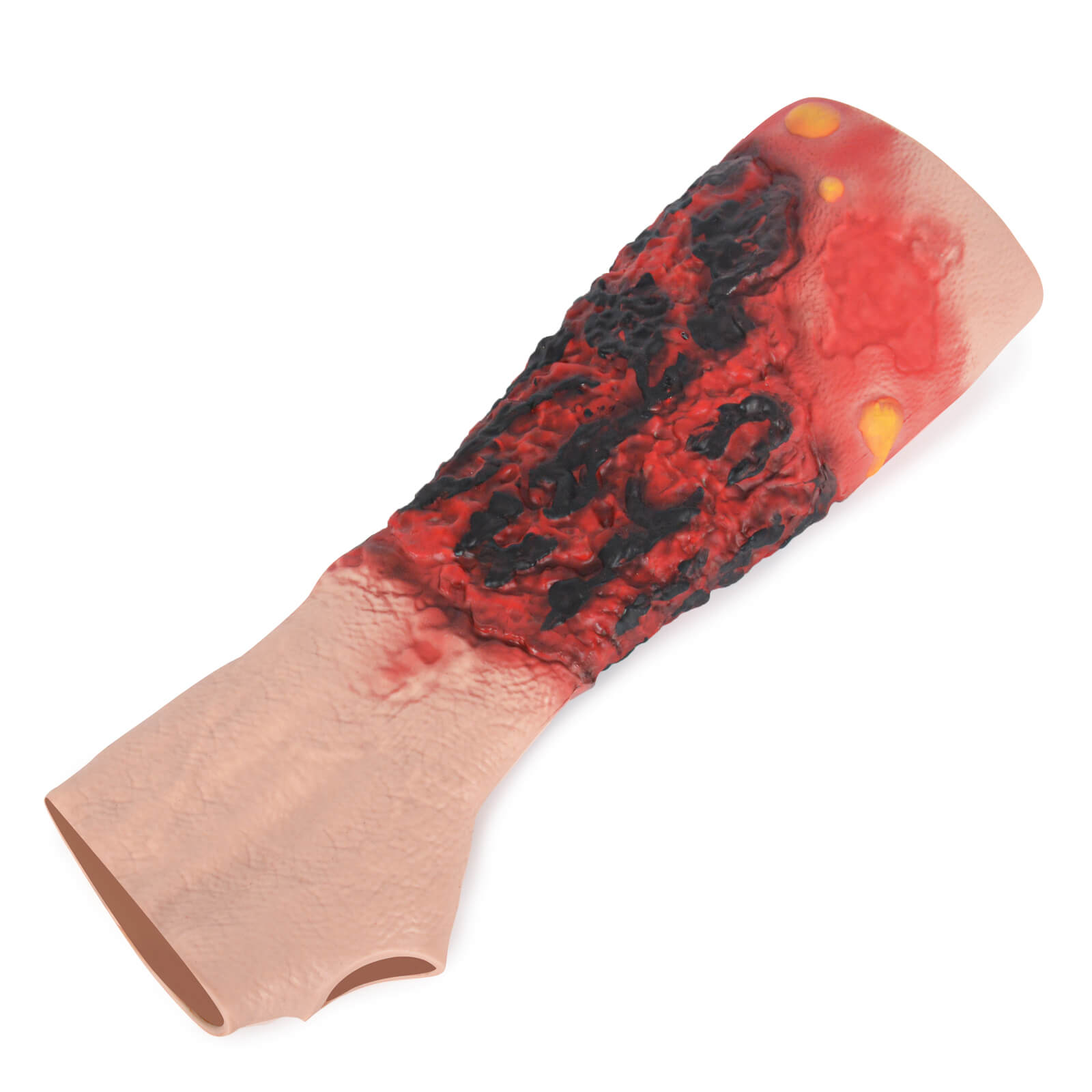 Wearable Forearm Burn Moulage