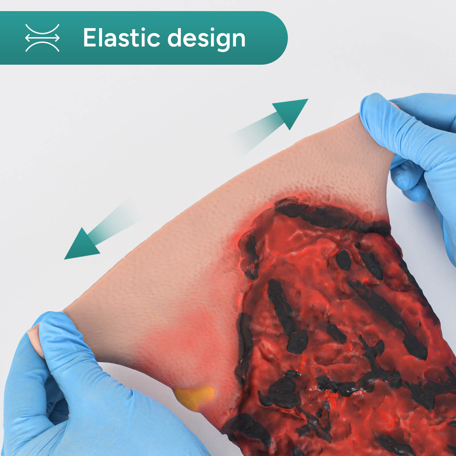 Wearable Forearm Burn Moulage