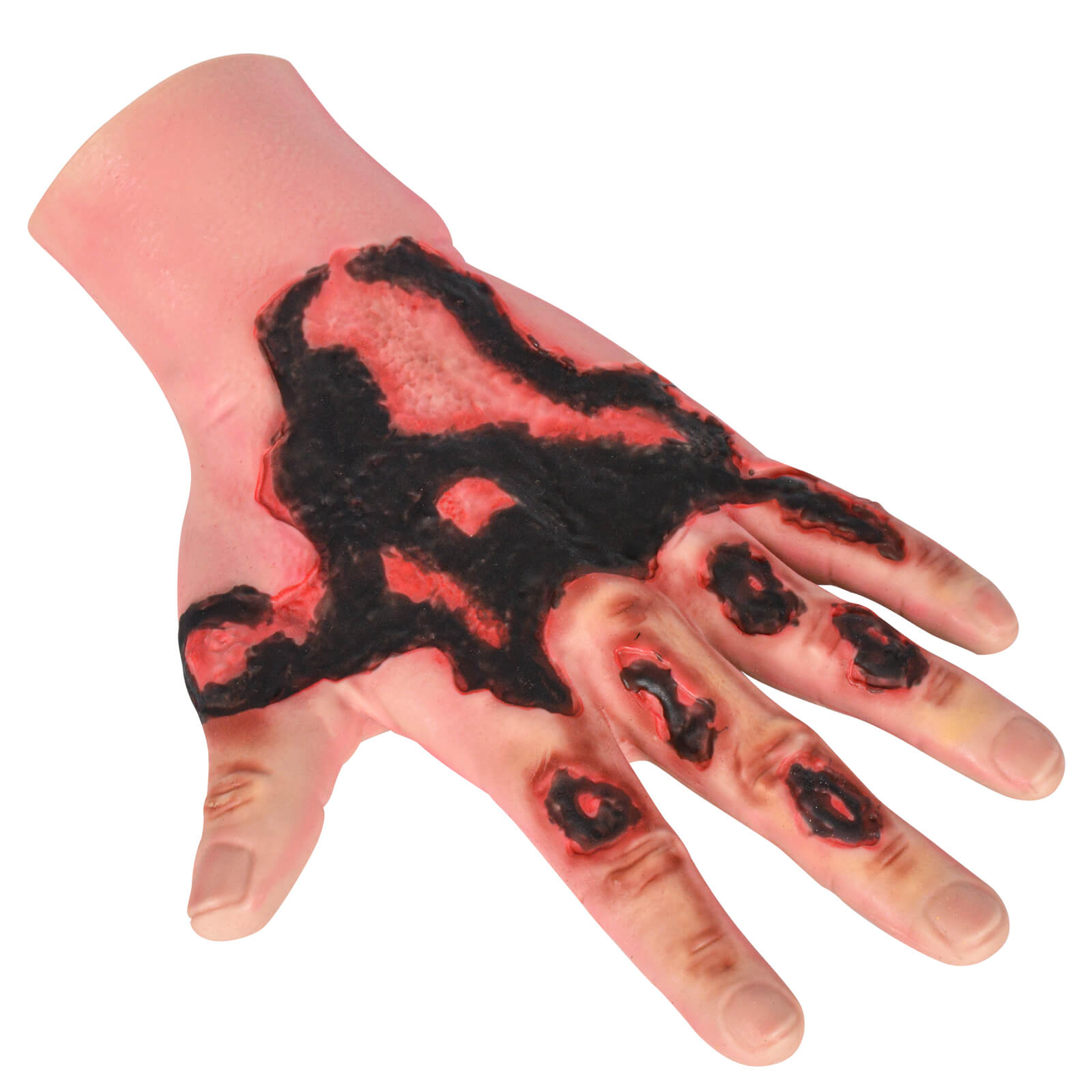 Wearable Hand Burn Moulage