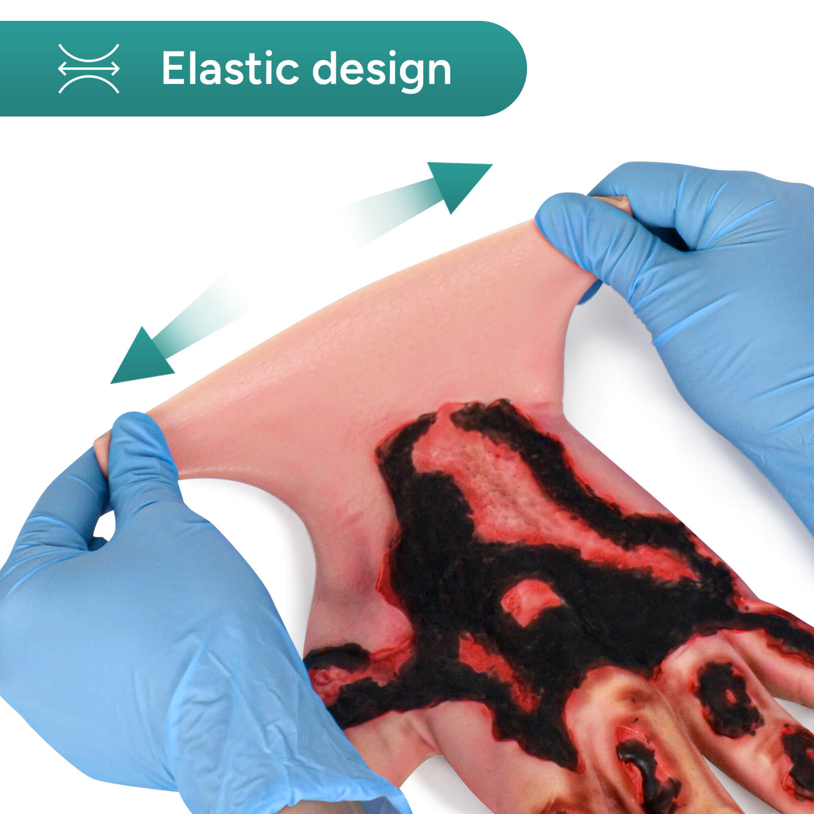 Wearable Hand Burn Moulage