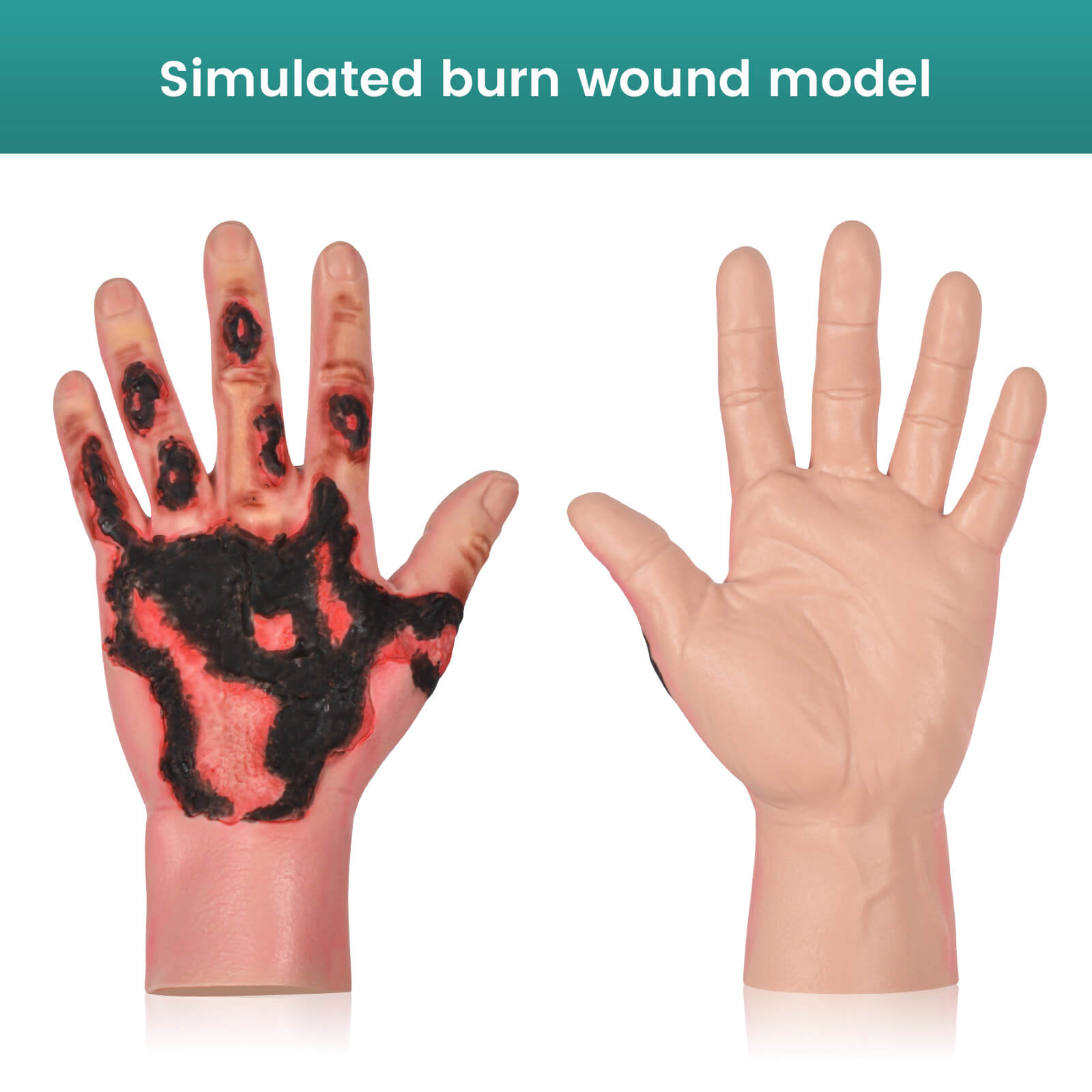 Wearable Hand Burn Moulage