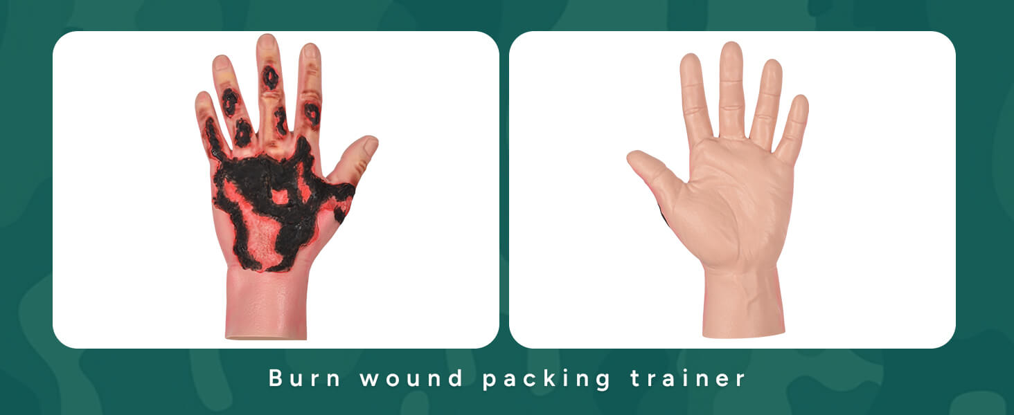 Third-Degree Hand Burn Wound Care Trainer