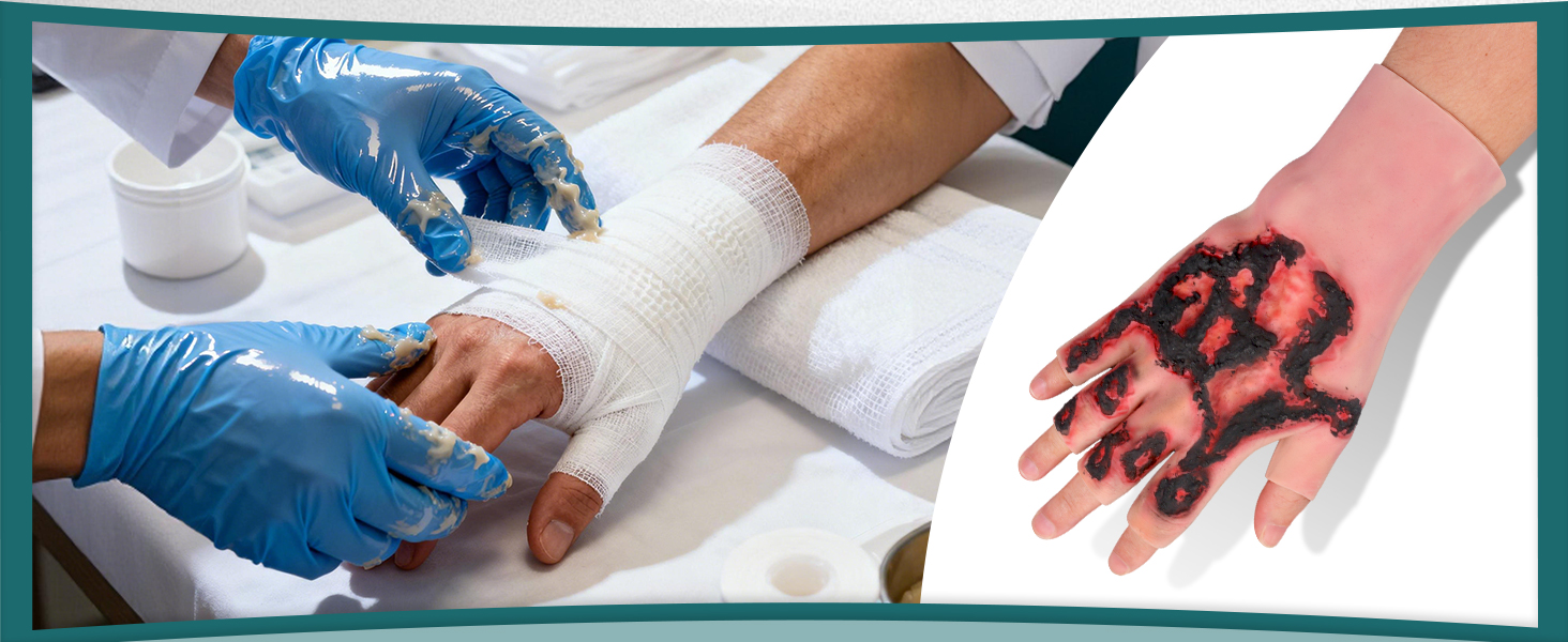 Third-Degree Hand Burn Wound Care Trainer (Hand Sleeve)