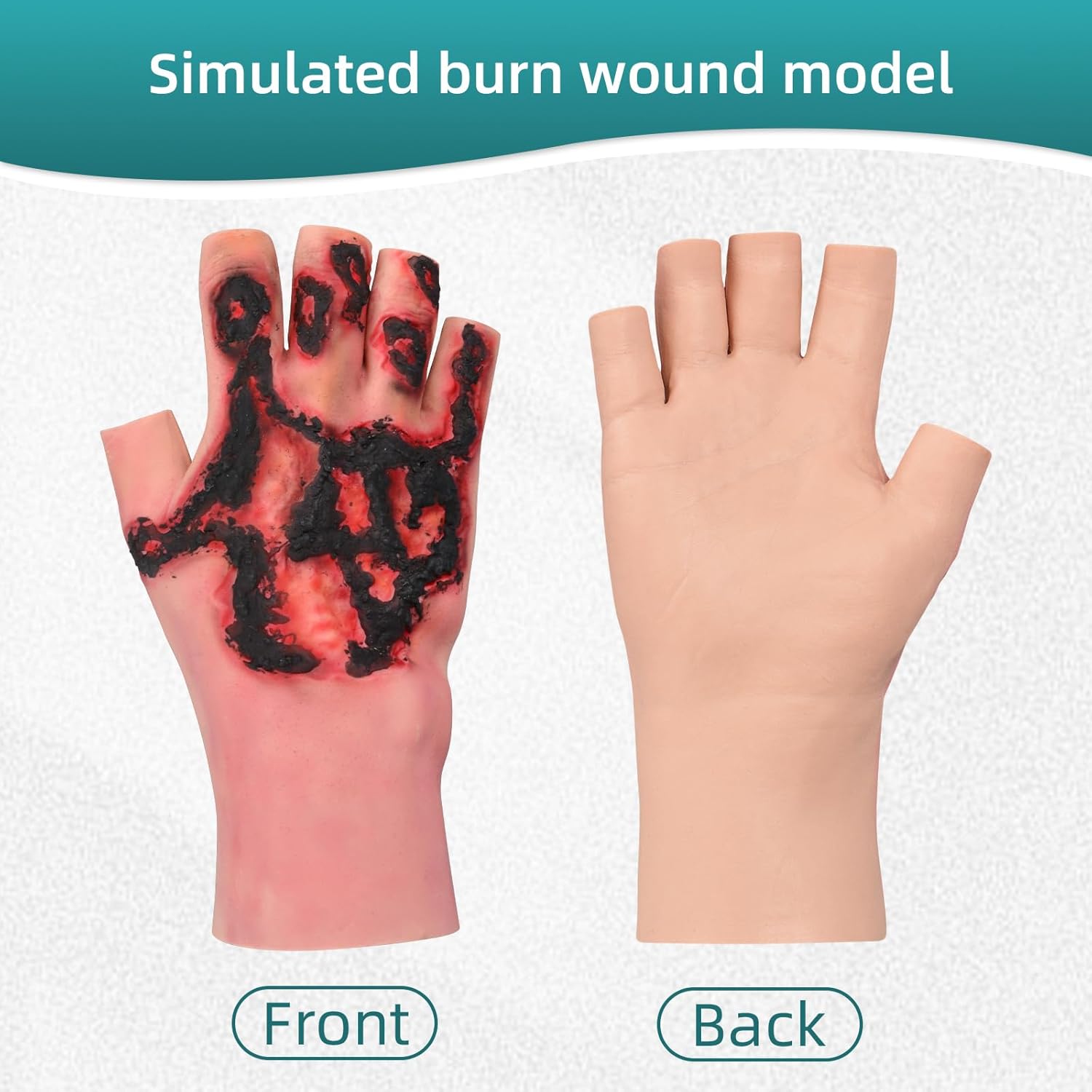 Wearable Hand Burn Moulage