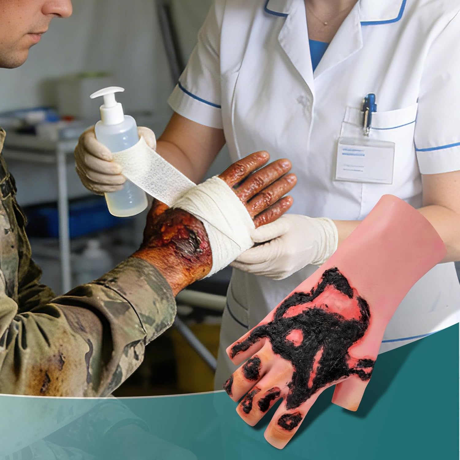 Wearable Hand Burn Moulage