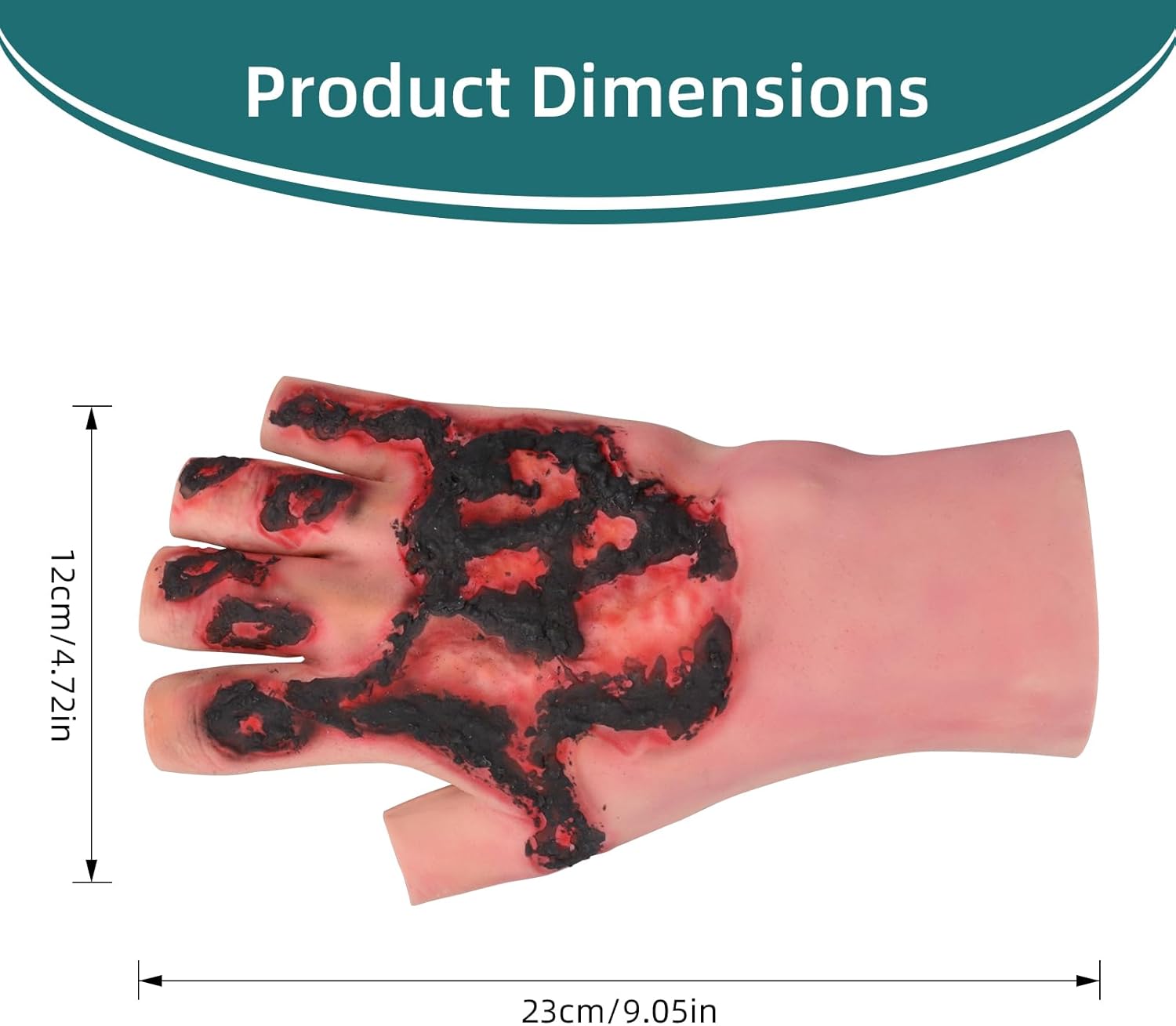Wearable Hand Burn Moulage