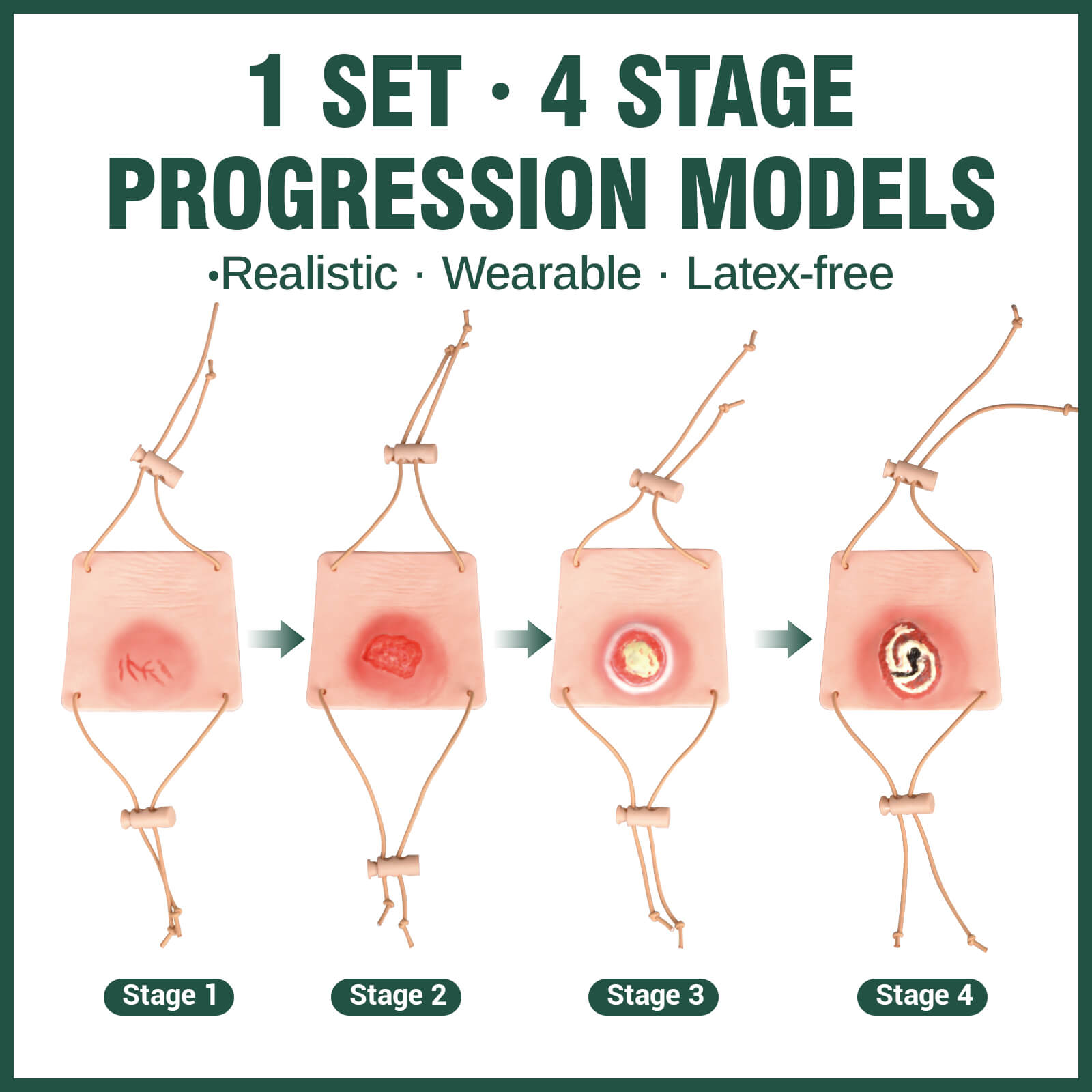 Wearable Heel Pressure Injury Simulation Model Set (Stage 1–4)