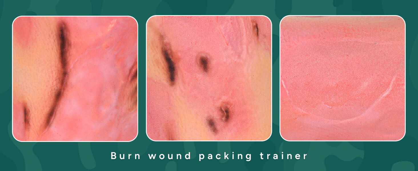 Leg Burn Wound Care Trainer (Leg Sleeve)