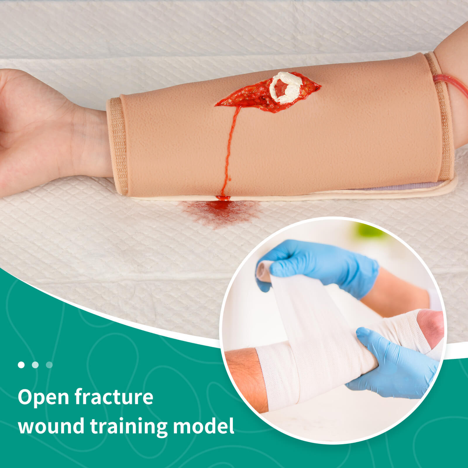 Wearable Open Fracture Wound Packing Trainer Kit, Second