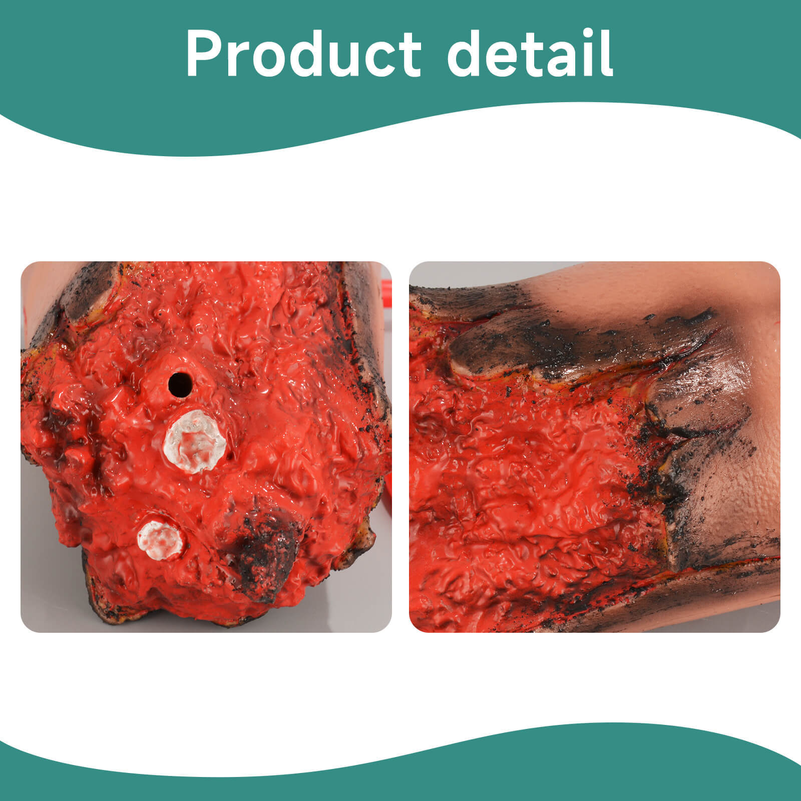 Wearable Severed Arm Trauma Model for Bleeding Control