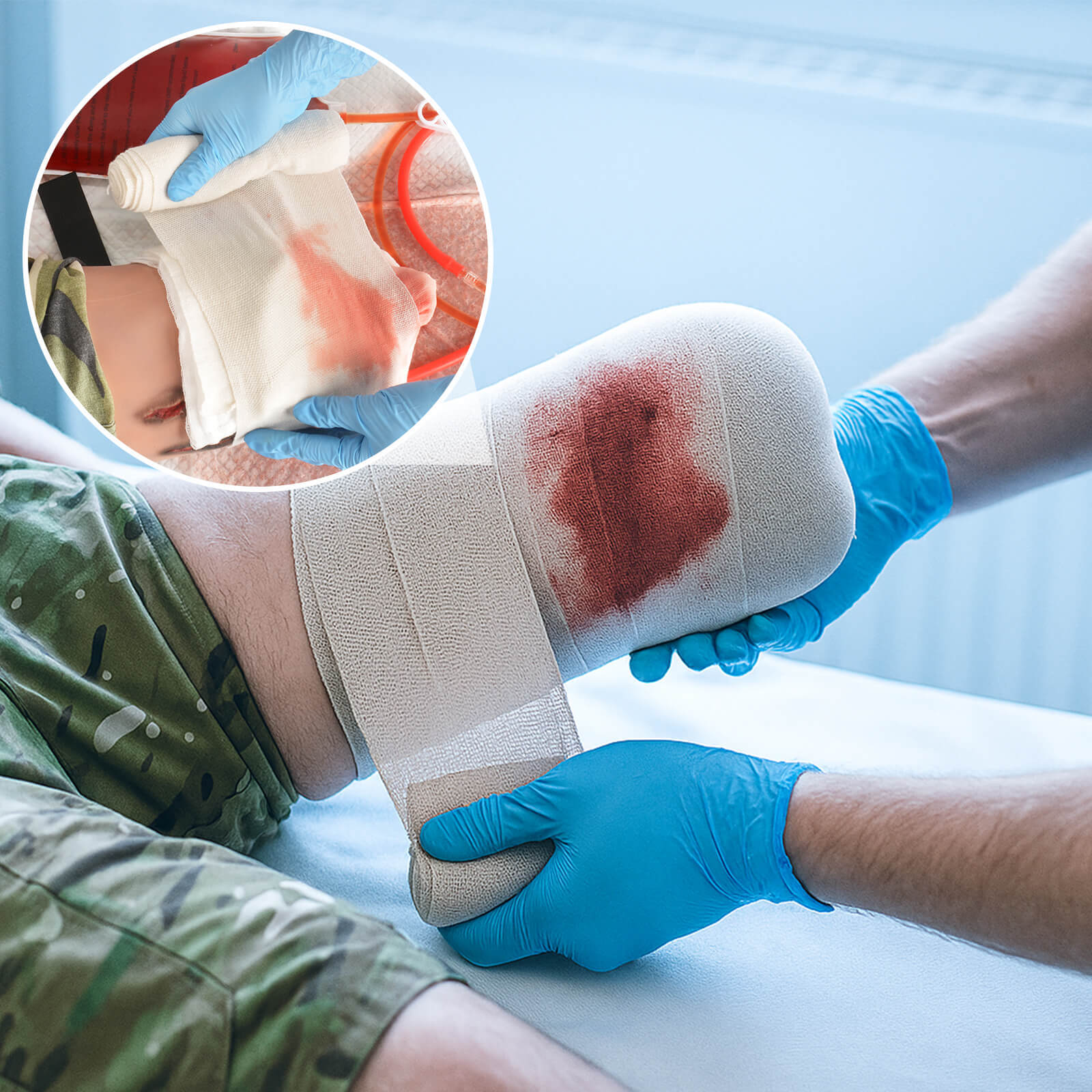 Wearable Severed Leg Trauma Model for Hemostasis Training