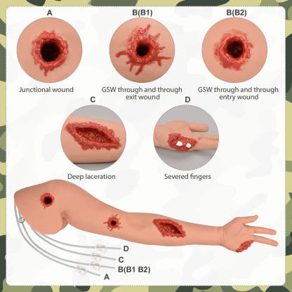Wearable Wound Packing Arm with Four Different Wounds