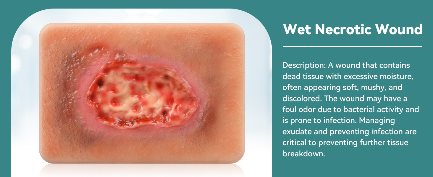 Wet Necrotic Wound Care Model