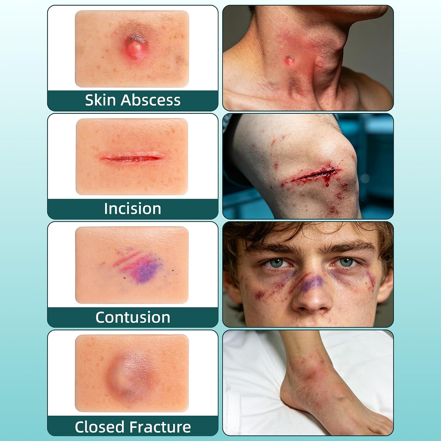 10-Piece Wound & Injury Recognition Training Kit
