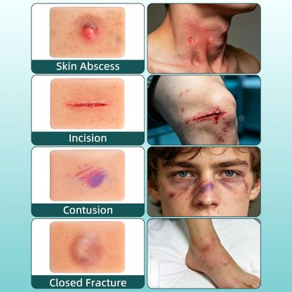 10-Piece Wound & Injury Recognition Training Kit
