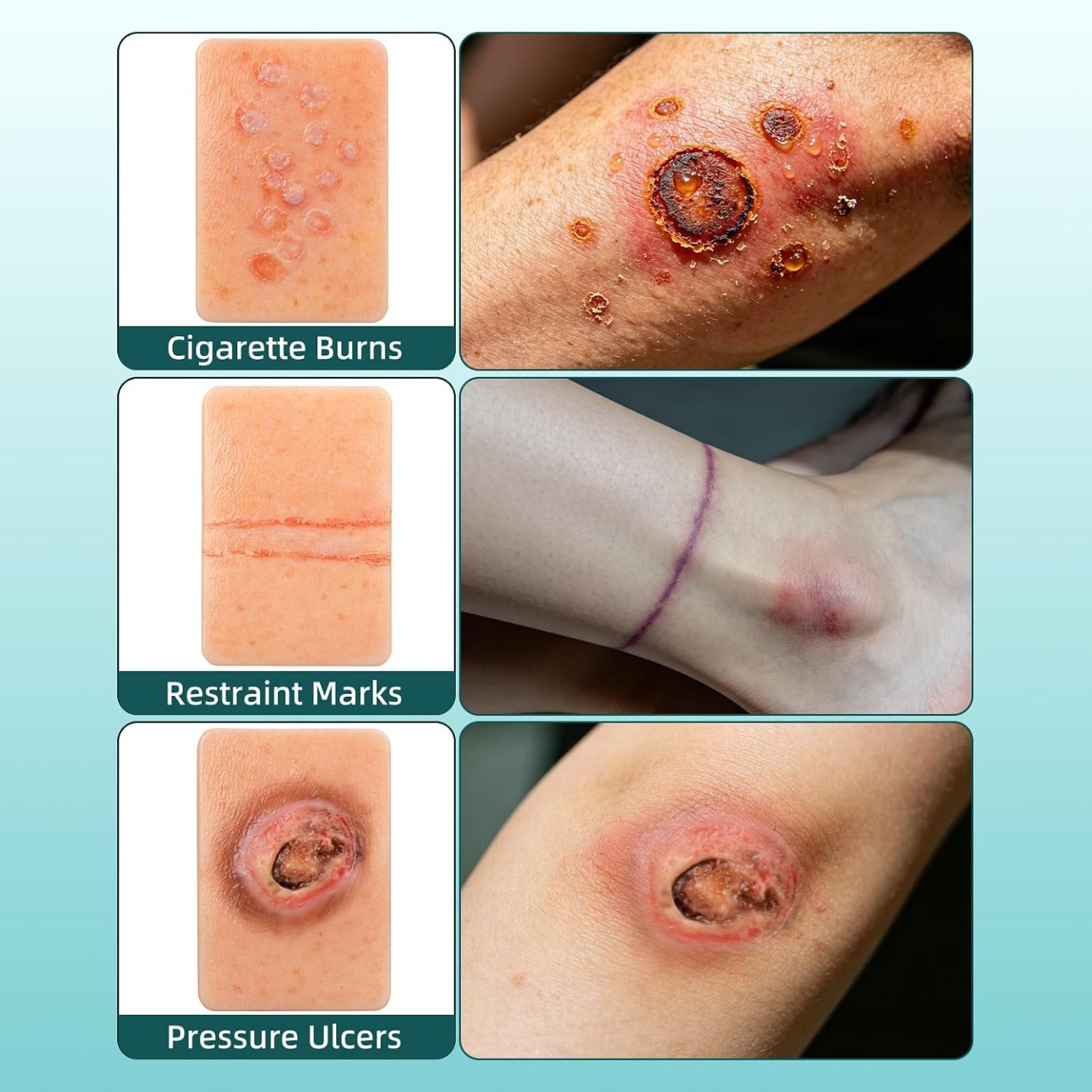 10-Piece Wound & Injury Recognition Training Kit