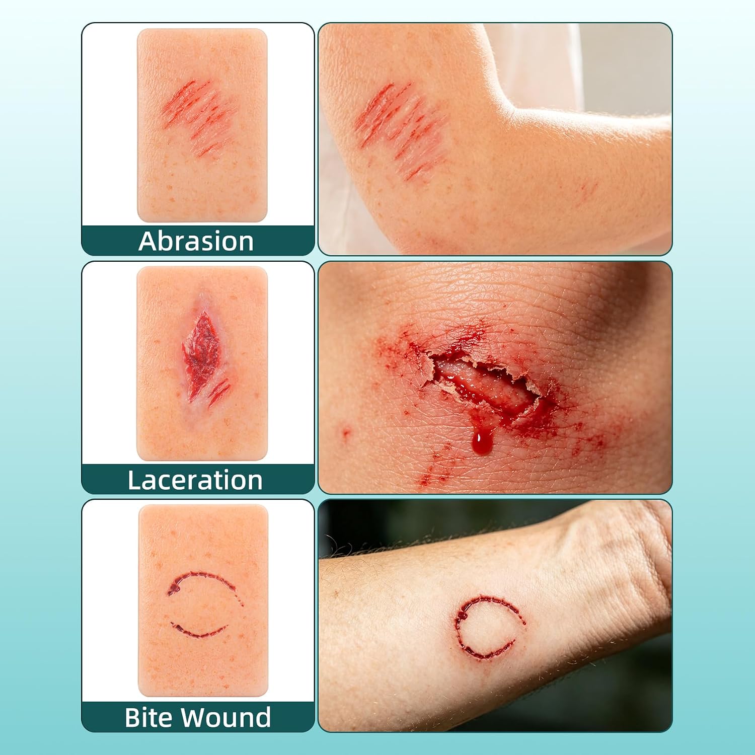 10-Piece Wound & Injury Recognition Training Kit