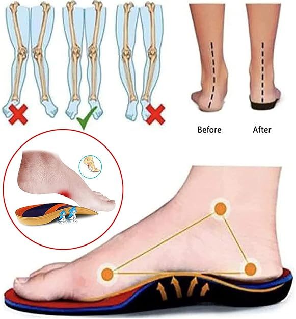 ⏰Promotion 60% OFF -Women's Ultra Soft Comfort Air Cushion Orthopedic Shoes