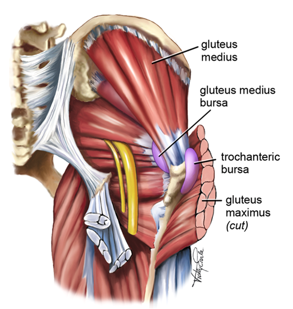 gluteal tendinopathy pain location​