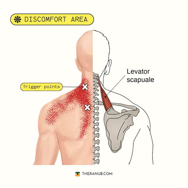 Levator Scapulae Trigger Points