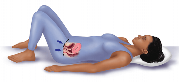 pelvic floor muscles cause sacrum pain