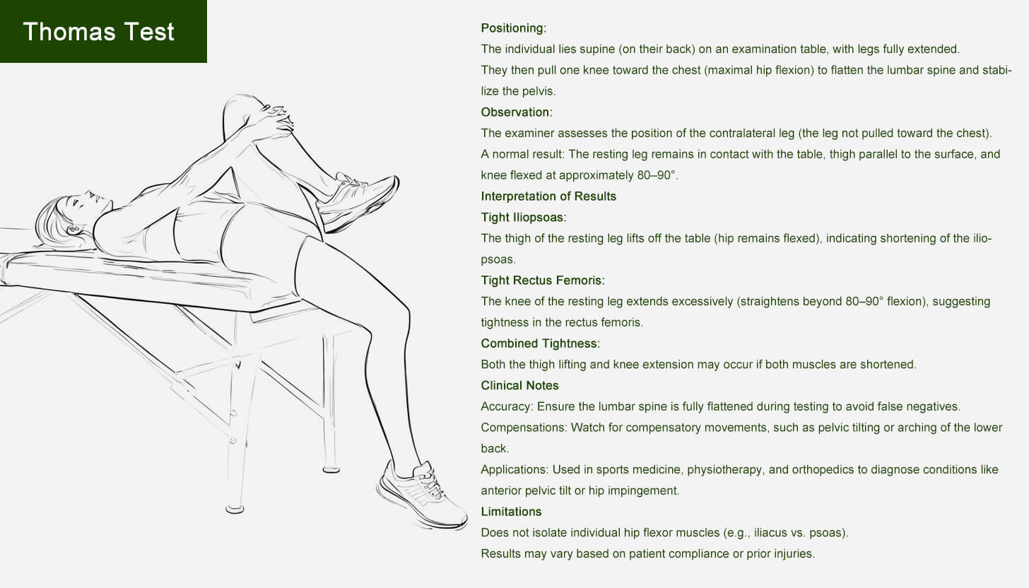 Thomas Test for sore iliacus muscle