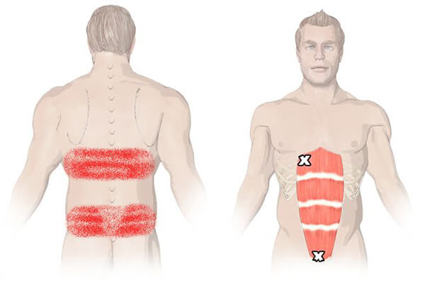 abdominal muscles trigger points