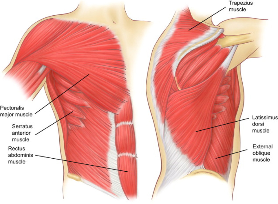 costochondritis Serratus Anterior