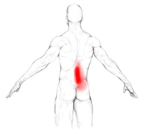 iliacus back pain​