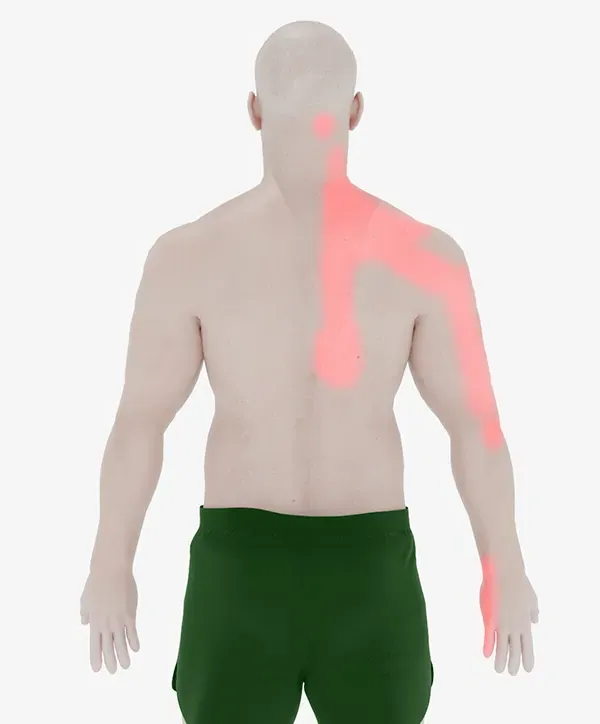 deep knots in shoulder blades symptoms​ pain at the right shoulder blade​​ and neck, radiating down the arm