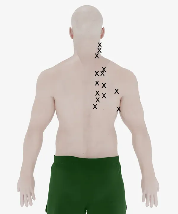 muscle knot in shoulder blade that won't go away​