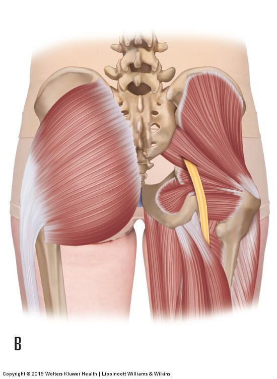 piriformis muscle sciatica gluteal tendinopathy