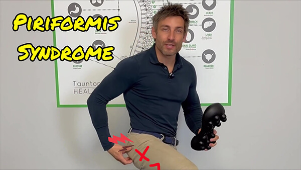 piriformis syndrome treatment