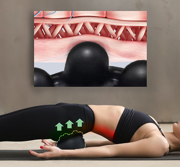 piriformis trigger points