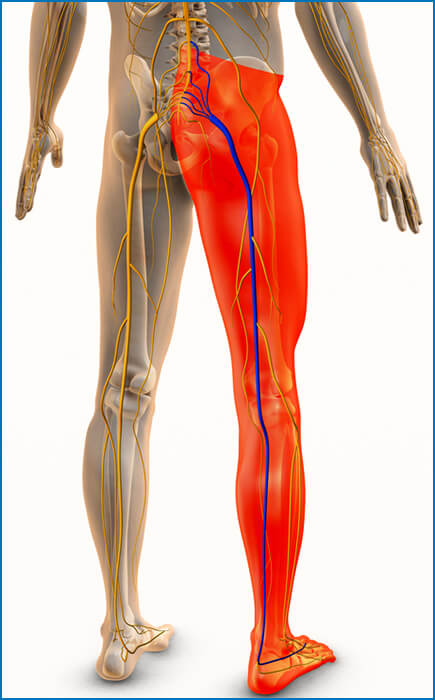 piriformis syndrome pain pattern​