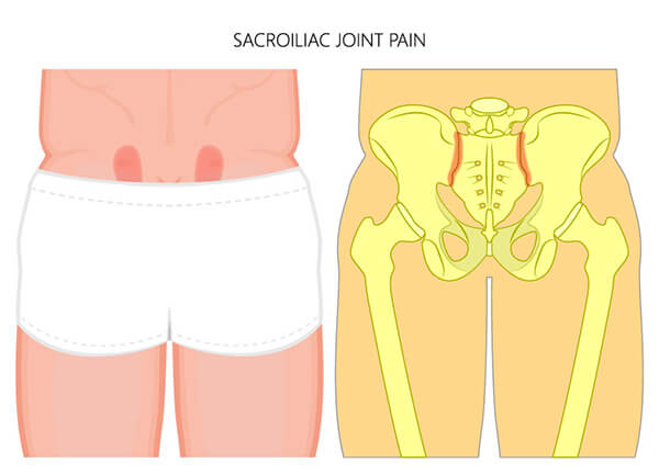 where is si joint pain felt​