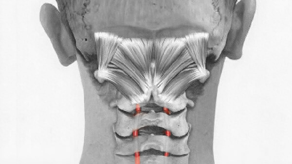 suboccipital muscle artery