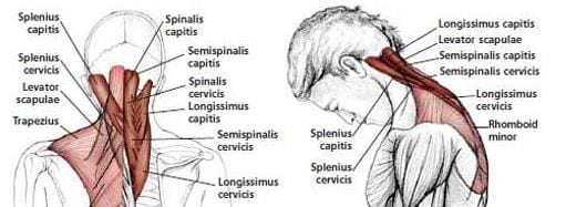 tech neck tight upper trapezius and others neck muscles