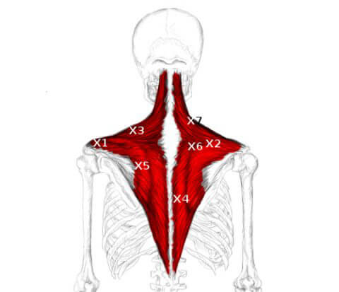 trapezius-trigger-points