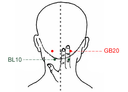 Occipital Neuralgia Trigger Points Massage