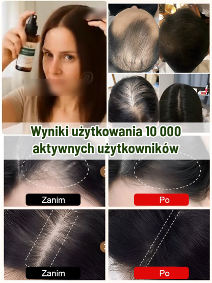 【Formuła Trychologów: Większa Objętość】Pożegnaj cienkie włosy i odzyskaj pewność siebie! Miliony zadowolonych użytkowników polecają